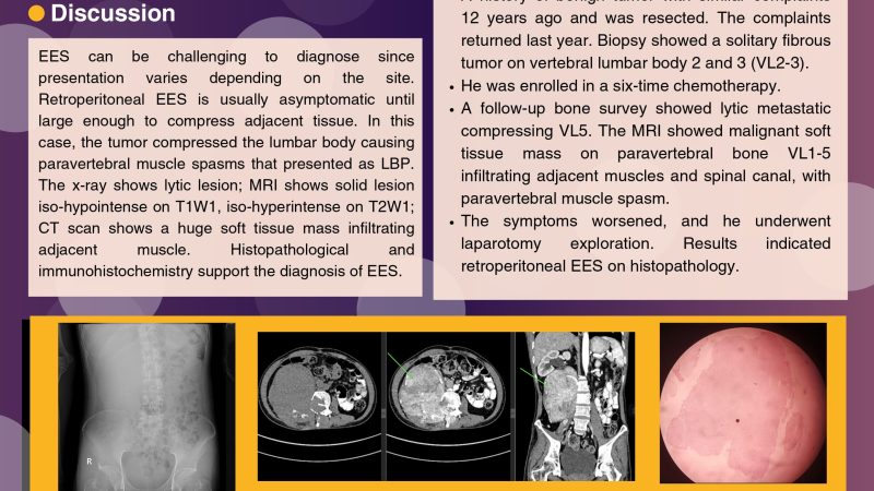 An Interesting Rare Case Report Ekstraskeletal Ewing Sarcoma in Adult- DEASY UMI HAJARSARI- PIT PDSRI_page-0001