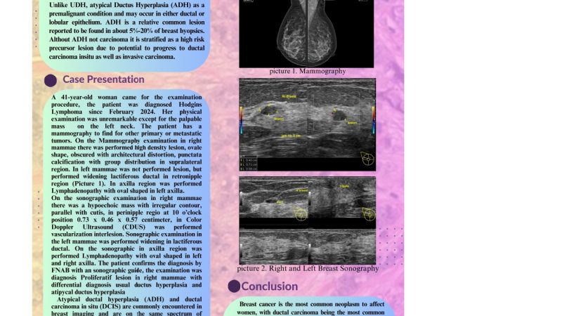 Atypical Ductal Hyperplasia And Usual Ductal Hyperplasia_Rizky Faisal.jpg_page-0001