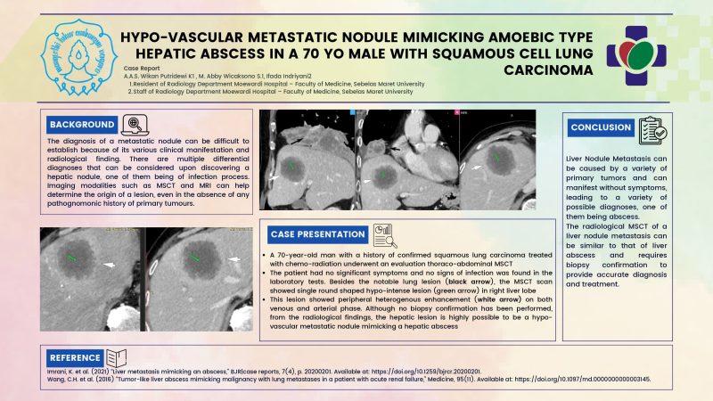 HYPOVASCULAR METASTATIC NODULE MIMICKING AMOEBIC TYPE HEPATIC ABCESS IN A 70 YO MALE WITH SQUAMOUS CELL LUNG CARCINOMA_page-0001