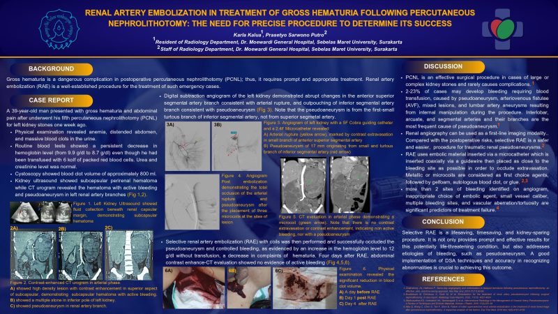 Karla Kalua_Renal Artery Embolization In Treatment Of Gross Hematuria Following Percutaneous Nephrolithotomy _E-Poster_page-0001