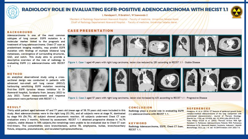 RADIOLOGY ROLE IN EVALUATING EGFR-POSITIVE ADENOCARCINOMA WITH RECIST 1.1 (2)_page-0001 (1)