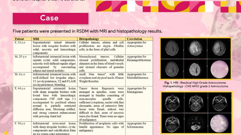 Radiologic Pathologic Correlation And Diagnostic Approach of Posterior Fossa Tumor- Deasy Umi_page-0001