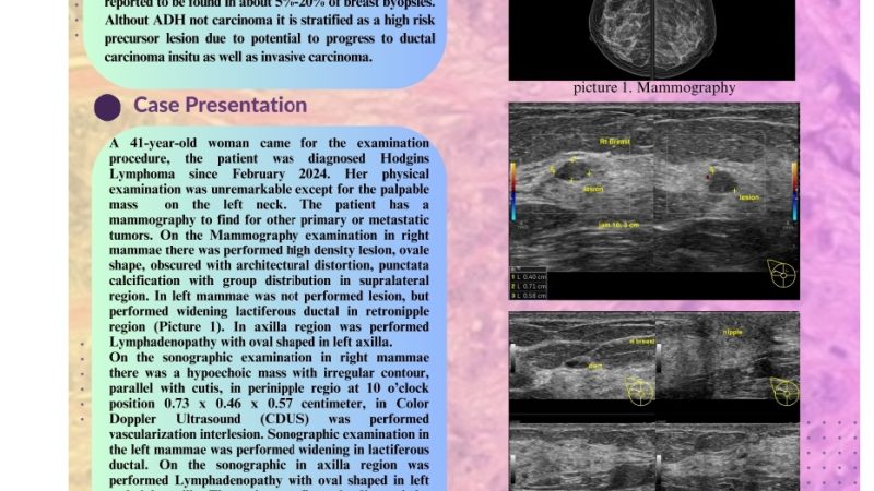 Atypical Ductal Hyperplasia And Usual Ductal Hyperplasia_Rizky Faisal.jpg_page-0001